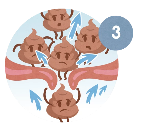 Tabla de popó - ¿Qué significa la popó de tu bebé?