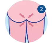 Sobre el estreñimiento: síntomas, causas y remedios