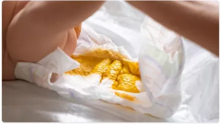 ¿Cómo reconocer una buena popó?