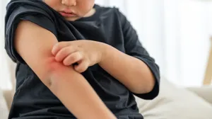 Herpangina en niños: causas, síntomas y tratamiento