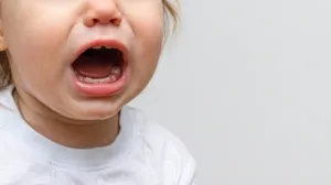 ¿Qué hacer si mi hijo tiene caries en  sus dientes de leche?